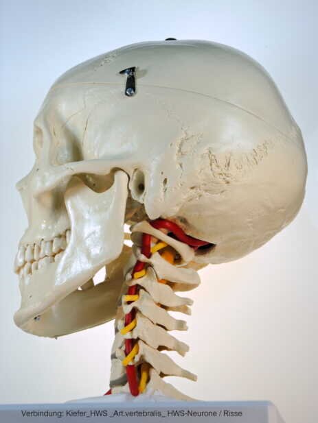 Verbindung: Kiefer / HWS / Art. Vertebralis / HWS-Neurone / Dr. Risse